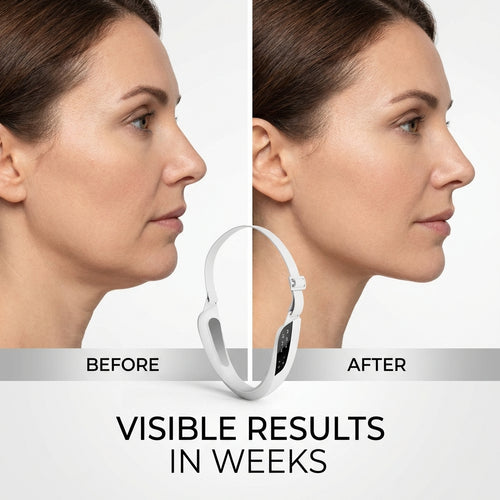 V-Lift Face Sculptor